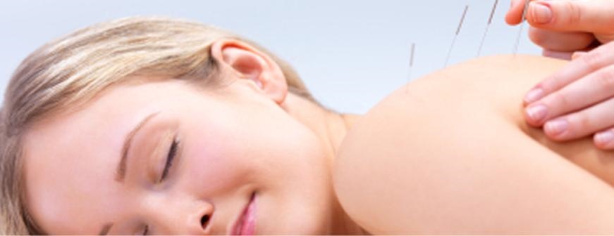 Acupuncture helps the body activating its own natural healing ability